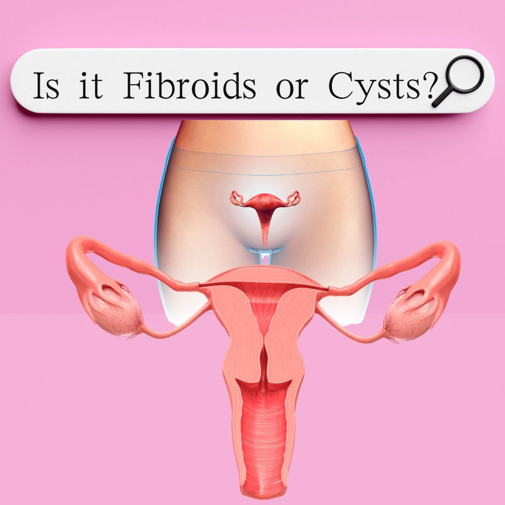 What is the difference between PCOS and Fibroids?